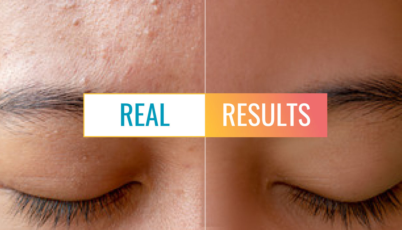 Real Results