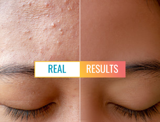 Real Results